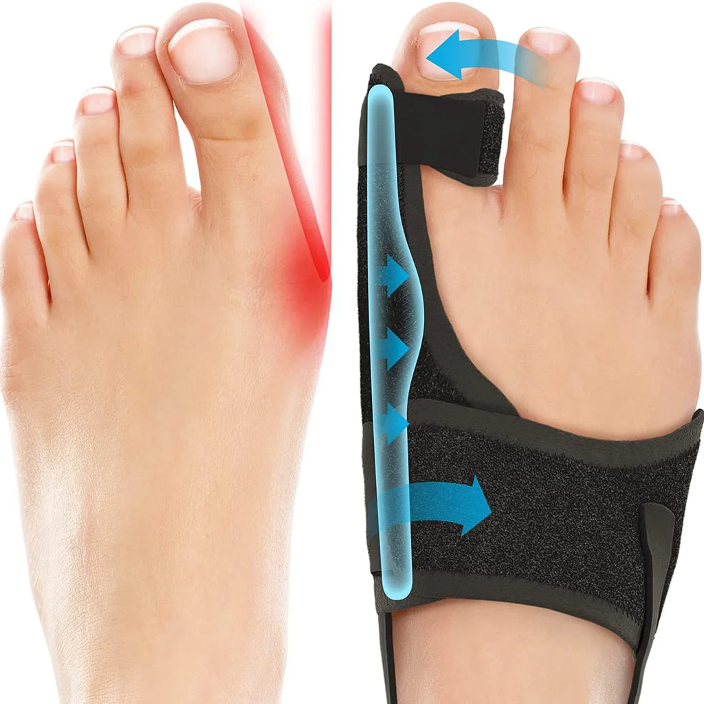 BackWell Bunion Corrector Splint