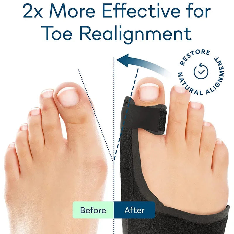 BackWell Bunion Corrector Splint